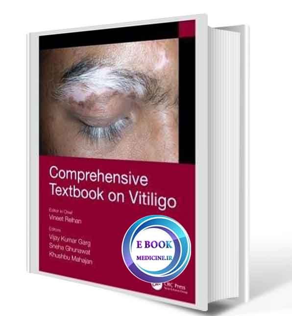 دانلود کتاب Comprehensive Textbook on Vitiligo2020(Original PDF)